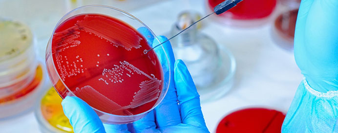 Microbiology & Serology in mulund