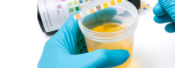 Urine & Stool Analysis in mulund